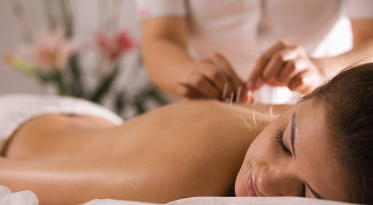 /content/dam/cultura-one/sélections/7-méthodes-pour-déstresser/TUTO_CMS_Acupuncture.jpg